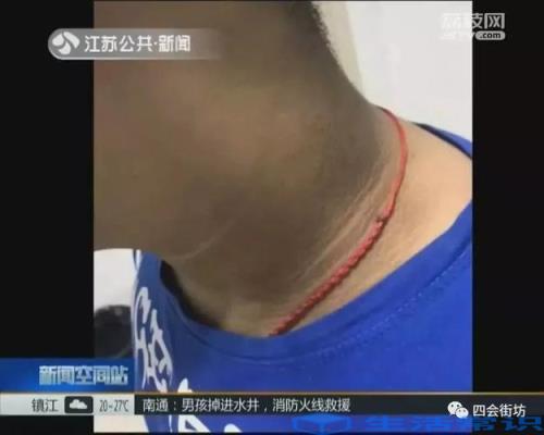 小孩脸上皮肤黑黑的怎么办?