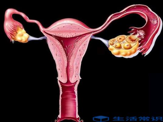 备孕遇上输卵管堵塞怎么办(检查输卵管堵塞后多久能备孕)