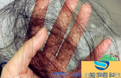 十个放化疗九个死是真是假